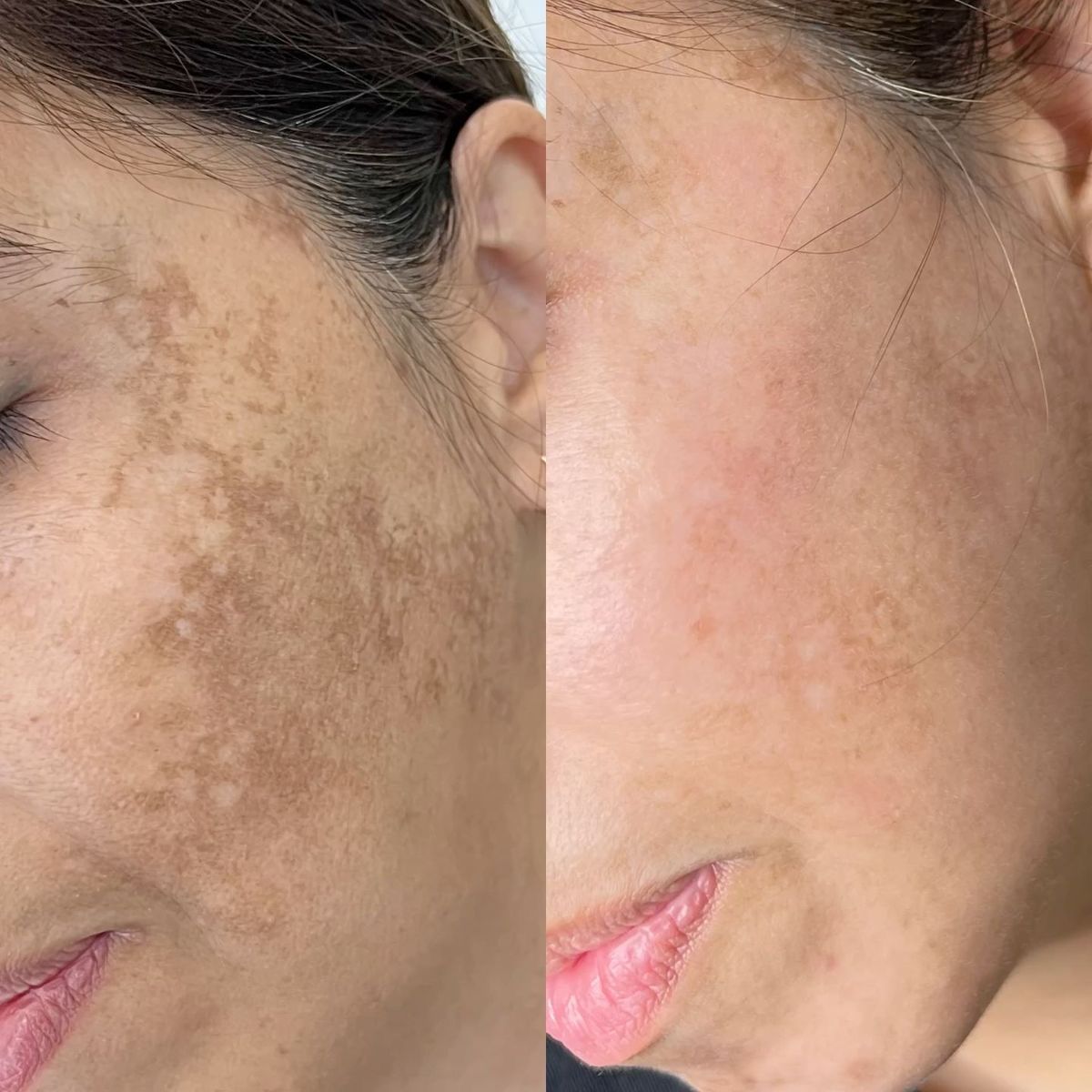 LUMINANCE Crema Aclarante 2X1