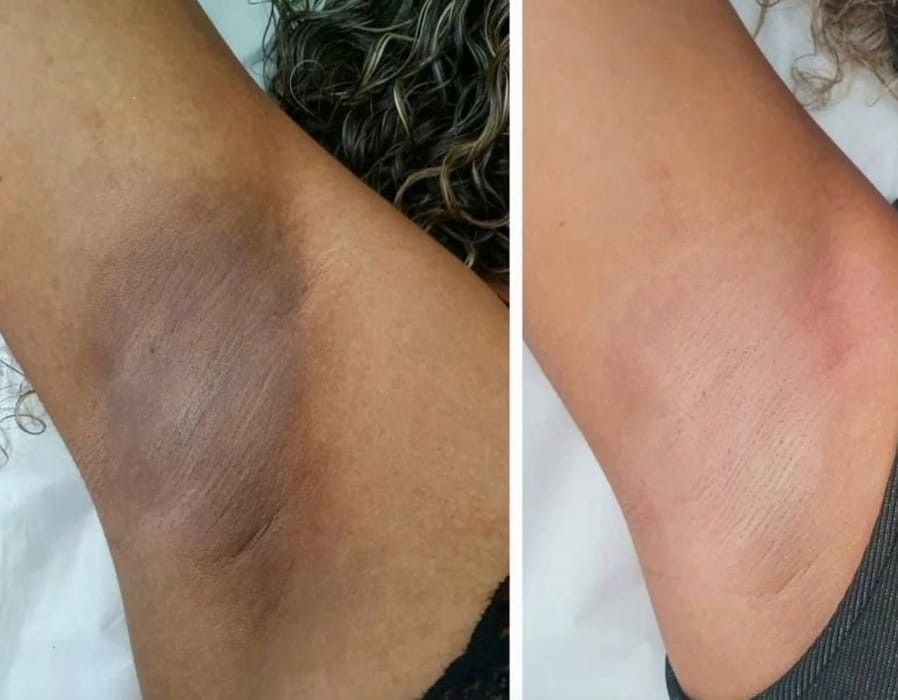 LUMINANCE Crema Aclarante 2X1